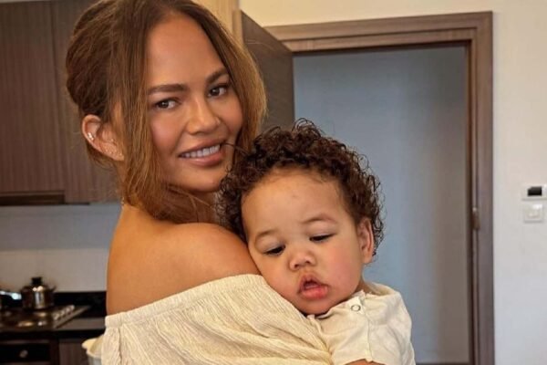 Chrissy Teigen’s son has Type 1 diabetes